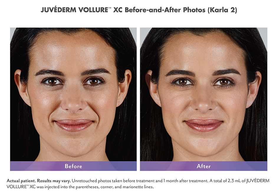 Lines Redwood Aesthetic Medicine